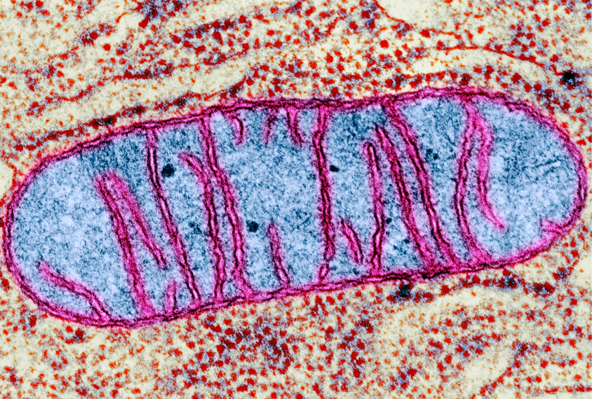 Dysfunctional Mitochondrion