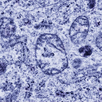 glioblastoma mitochondria